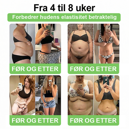 Som en verdsatt kunde har du låst opp en helt spesiell bonus! Få 80 % rabatt når du legger til enda et 𝑨𝑴𝒁𝑲𝑬𝑬𝑷®-produkt i bestillingen din. Dette overraskelsestilbudet gjelder bare i en kort periode.
